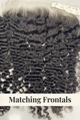Frontal photo labeled Matching Frontals